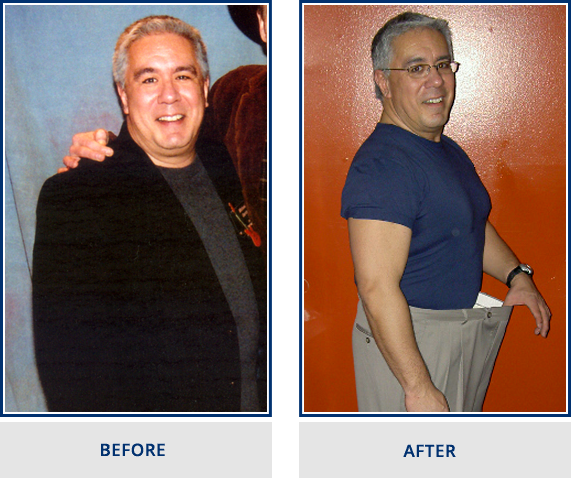 halina-before-after