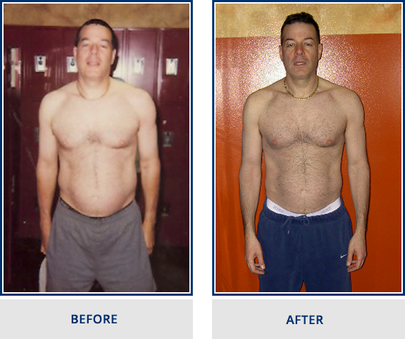 halina-before-after